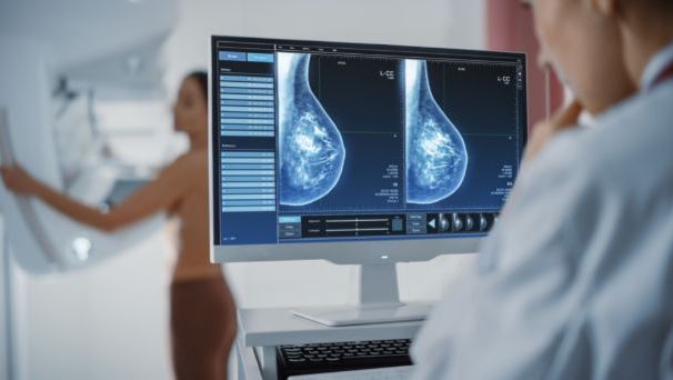 Mammography (of both breasts)