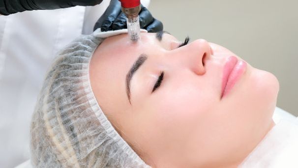 Mikronakłuwanie skóry twarzy i szyi