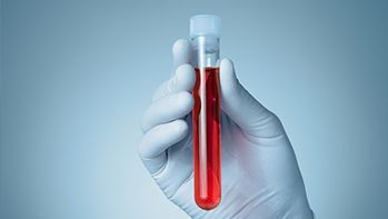 Pakiet badań przed operacją lub zabiegiem