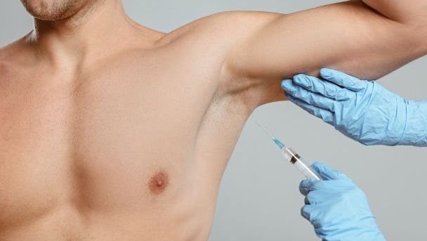 Toksyna Botulinowa Botox/Vistabel - leczenie nadpotliwości pach