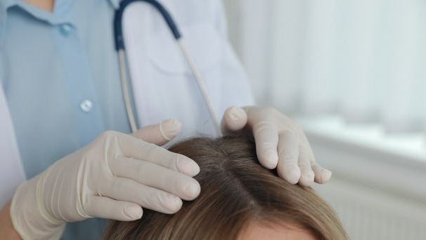 Trichoskopia – konsultacja dermatologa z badaniem