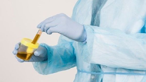 Konsultacja profesorska - urologia