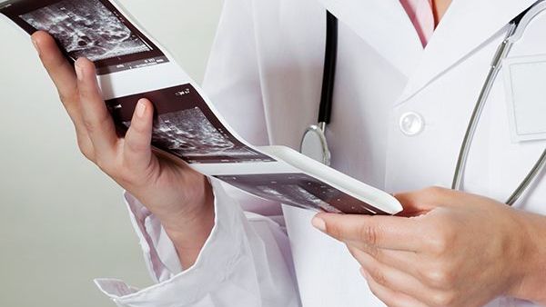 USG Doppler tętnic nerkowych