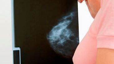 USG sutka (piersi) z elastografią