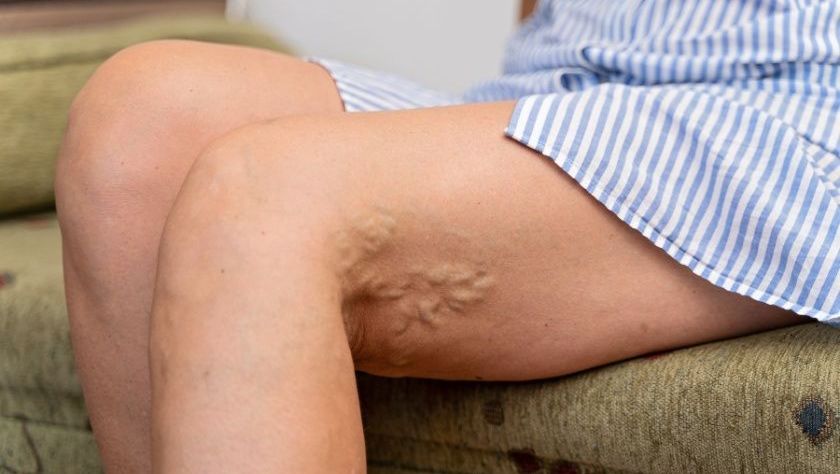 Pakiet badań - diagnostyka zakrzepicy