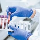 Glukoza 30 min po posiłku