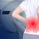 Rezonans magnetyczny kręgosłupa lędźwiowego bez kontrastu