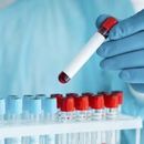 P.ciała przeciw kleszczowemu zapaleniu mózgu IgG