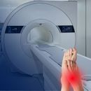 Rezonans magnetyczny stopy bez kontrastu