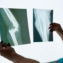 RTG kończyn dolnych na stojąco