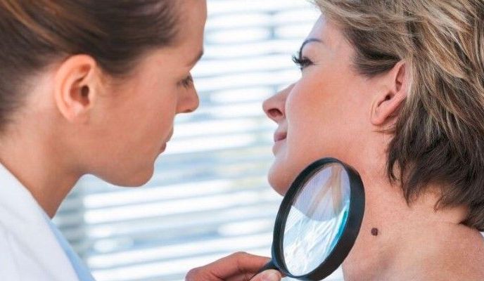 Czerniak – czynniki ryzyka, objawy i diagnostyka nowotworu skóry