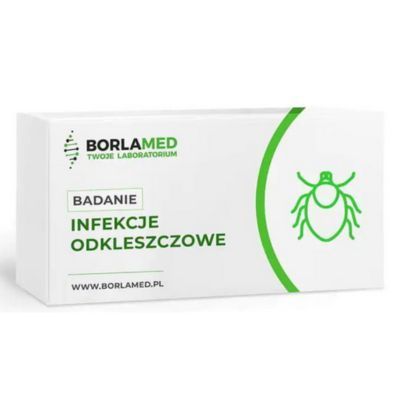 Przeciwciała p-c Borrelia burgdorferi IgM lub IgG metoda Western-blot