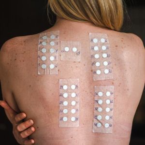 Testy kontaktowe płatkowe - standard europejski