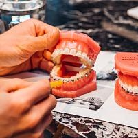 Konsultacja ortodontyczna