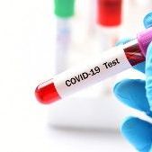 Przeciwciała po przechorowaniu SARS-CoV-2 całkowite ilościowo