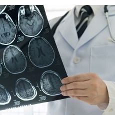 Rezonans magnetyczny kręgosłupa szyjnego