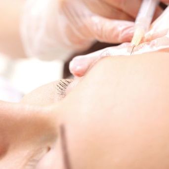 Osocze bogatopłytkowe – duże