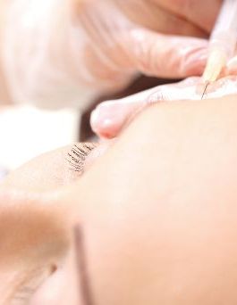 Osocze bogatopłytkowe – małe