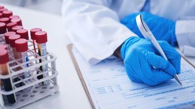 Badanie PSA całkowity