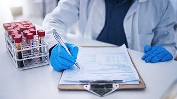 Przeciwciała przeciw HBs - całkowite