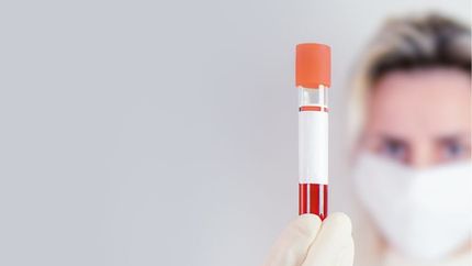 Pakiet badań - FibroTest - pełne badanie