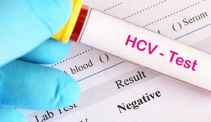 Wirus HCV – zakażenie, objawy WZW, diagnoza zapalenia wątroby typu C