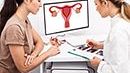 Ginekolog dorośli - kwalifikacja do zabiegu endometriozy