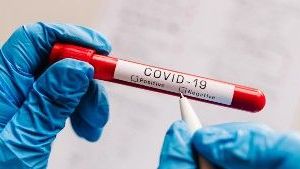 Szybki test antygenowy Lumira 2 w 1 (koronawirus SARS CoV-2 i grypa)