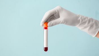 Pakiet badań Profilaktyka przedekspozycyjna HIV (PrEP) – do wizyty kwalifikującej