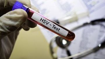 HSV – DNA – wymaz Nucleagena
