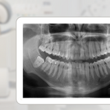 Panthomographic x-ray