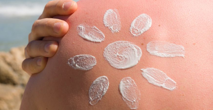 Pierwsze objawy oparzenia słonecznego pojawiają się do pierwszych 12 godzin po ekspozycji. Szczególnie narażona na oparzenia słoneczne jest twarz. Pierwsza pomoc w przypadku oparzenia słonecznego to stopniowe ochłodzenie i nawilżenie skóry.