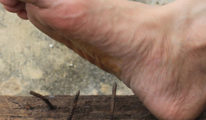 W wyniku niedoboru magnezu i potasu może dojść do skurczu mięśni, czyli wystąpienia tężyczki.