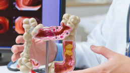 Kolonoskopia z biopsją/polipektomią i badaniem histopatologicznym