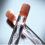 Rezerwa jajnikowa – hormon AMH