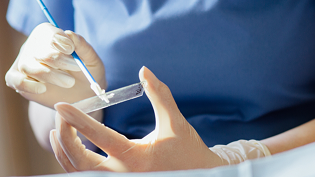 Cytologia LBC + HPV 14