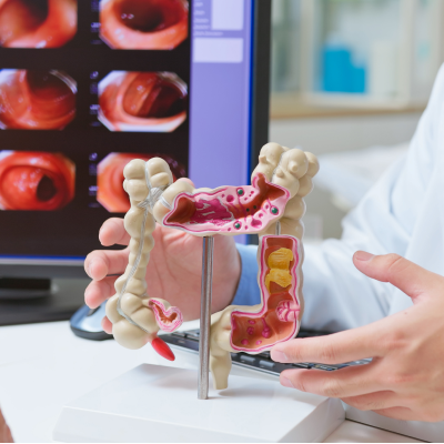 Czym jest kolonoskopia ze znieczuleniem z biopsją/polipektomią i badaniem histopatologicznym?